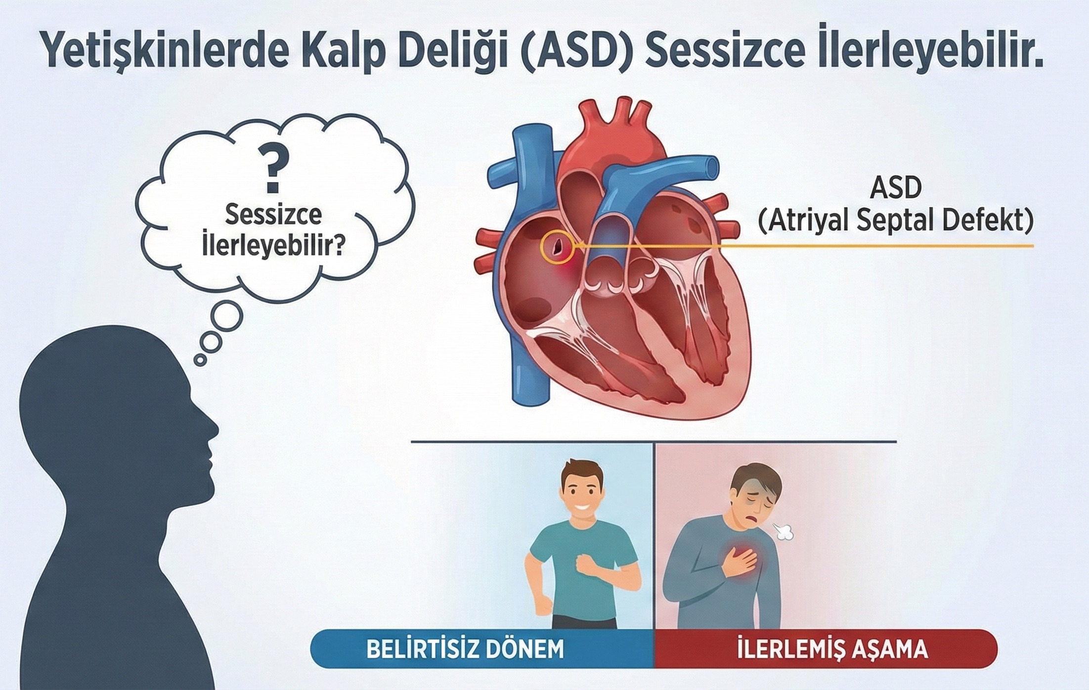 ASD